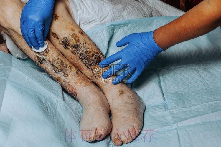 跟队记者：米利唐右大腿受伤 具体伤愈时间未知